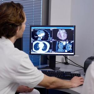 Cardiac CT images